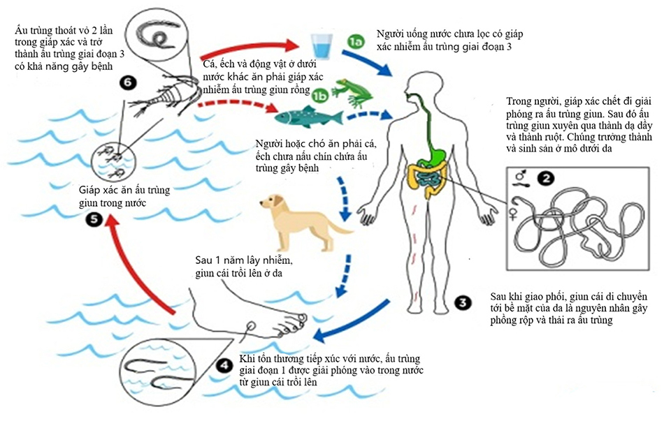 Nguy cơ mắc bệnh giun s&aacute;n, k&yacute; sinh tr&ugrave;ng